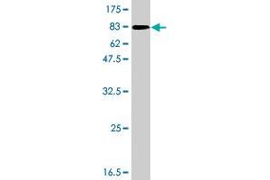 Western Blot detection against Immunogen (93. (RHOBTB3 anticorps  (AA 1-611))