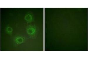 Immunofluorescence analysis of HuvEc cells, using NMDAR2A/B (Phospho-Tyr1246/1252) Antibody. (NMDAR2A + 2B anticorps  (pTyr1246))