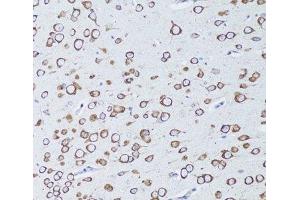 Immunohistochemistry of paraffin-embedded Mouse brain using TNFRSF11A Polyclonal Antibody at dilution of 1:100 (20x lens). (TNFRSF11A anticorps)