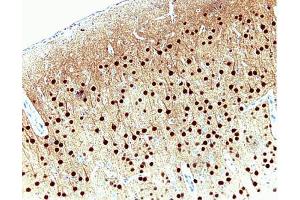 Pyrimidal cells in rat cortex, formalin-fixed paraffin embedded tissue, no pre-treatment, 20X (CAMK4 anticorps  (AA 1-241))