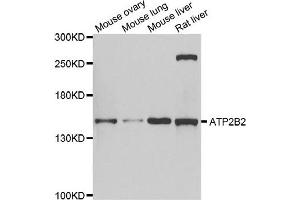Western blot analysis of extracts of various cell lines, using ATP2B2 antibody. (ATP2B2 anticorps)