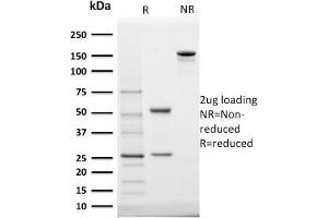 anti-Steroidogenic Acute Regulatory Protein (STAR) (AA 39-108) antibody