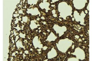 ABIN6276724 at 1/100 staining Mouse lung tissue by IHC-P.