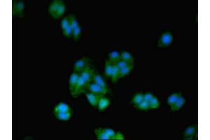 Immunofluorescent analysis of HepG2 cells using ABIN7172487 at dilution of 1:100 and Alexa Fluor 488-congugated AffiniPure Goat Anti-Rabbit IgG(H+L) (BTF3 anticorps  (AA 48-206))