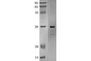 Validation with Western Blot (Desmin Protein (DES) (His tag))