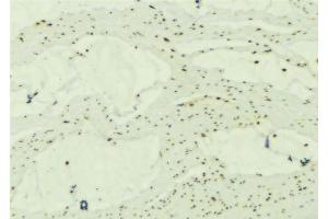 ABIN6277244 at 1/100 staining Mouse muscle tissue by IHC-P. (SNCG anticorps  (C-Term))