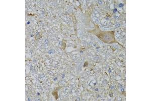 Immunohistochemistry of paraffin-embedded mouse brain using CALML5 antibody (ABIN5974468) at dilution of 1/100 (40x lens). (CALML5 anticorps)