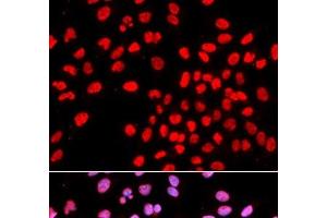 Immunofluorescence analysis of U2OS cells using IKZF1 Polyclonal Antibody (IKZF1 anticorps)