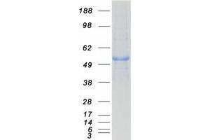 Validation with Western Blot