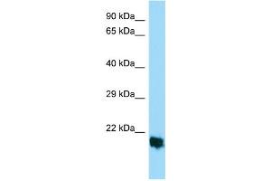 Host: Rabbit Target Name: MPLKIP Sample Type: HepG2 Whole Cell lysates Antibody Dilution: 1. (TTDN1 anticorps  (Middle Region))