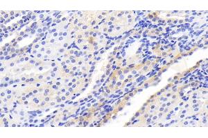 Detection of mTOR in Human Kidney Tissue using Monoclonal Antibody to Serine/threonine-protein kinase mTOR (mTOR)