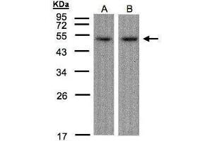 WB Image Sample(30 μg of whole cell lysate) A:Hep G2, B:Raji, 12% SDS PAGE antibody diluted at 1:1500