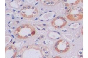 anti-Metalloproteinase Inhibitor 2 (TIMP2) (AA 27-220) antibody