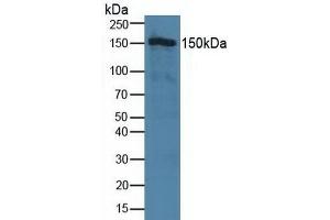 Detection of TJP2 in Human Hela Cells using Polyclonal Antibody to Tight Junction Protein 2 (TJP2) (TJP2 anticorps  (AA 307-669))