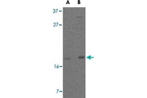 Western blot analysis of DPPA3 in 293 cell lysate with DPPA3 polyclonal antibody  at (A) 1 and (B) 2 ug/mL . (DPPA3 anticorps  (C-Term))