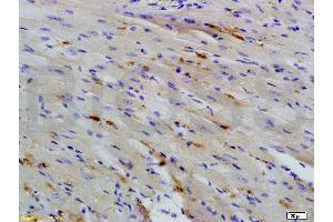 Formalin-fixed and paraffin embedded mouse heart tissue labeled with  (ABIN723905)  Rabbit Anti-BTG2 TIS21 Polyclonal Antibody at 1: 200 followed by incubation with conjugated secondary antibody and DAB staining.