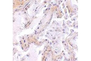 Immunohistochemistry of CAPN6 in human lung tissue with CAPN6 polyclonal antibody  at 2. (Calpain 6 anticorps  (C-Term))