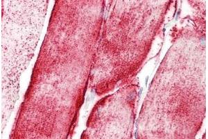 Human Skeletal Muscle: Formalin-Fixed, Paraffin-Embedded (FFPE) (STOX1 anticorps  (C-Term))