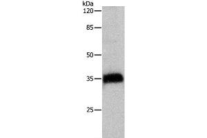 Western Blot analysis of Hela cell using CTSZ Polyclonal Antibody at dilution of 1:500 (Cathepsin Z anticorps)