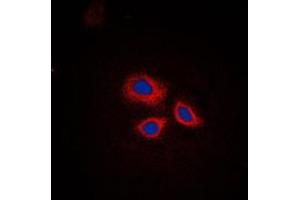Immunofluorescent analysis of RNF144A staining in HepG2 cells. (RNF144A anticorps  (Center))