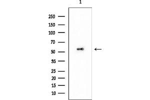 anti-TBC1 Domain Family, Member 21 (TBC1D21) antibody