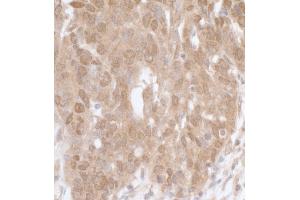 Immunohistochemistry (IHC) image for anti-Mitogen-Activated Protein Kinase-Activated Protein Kinase 5 (MAPKAPK5) (AA 423-473) antibody (ABIN7453731) (MAPKAP Kinase 5 anticorps  (AA 423-473))