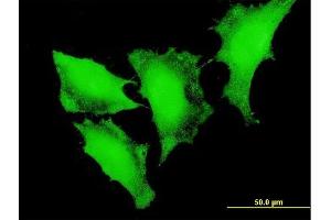 Immunofluorescence of monoclonal antibody to FOXO3 on HeLa cell. (FOXO3 anticorps  (AA 361-460))