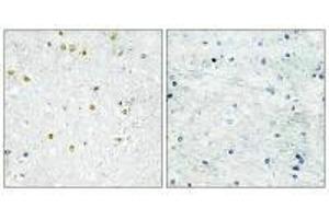 Immunohistochemistry analysis of paraffin-embedded human brain tissue using TRIM24 antibody. (TRIM24 anticorps  (C-Term))
