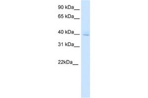 Western Blotting (WB) image for anti-Diencephalon/mesencephalon Homeobox 1 (DMBX1) antibody (ABIN2461530) (DMBX1 anticorps)