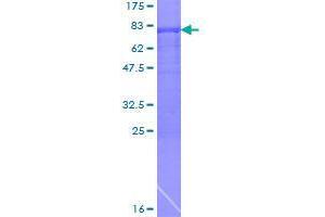 Image no. 1 for ADP-Ribosylation Factor GTPase Activating Protein 1 (ARFGAP1) (AA 1-406) protein (GST tag) (ABIN1345471)