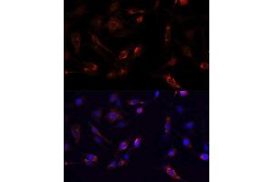 Immunofluorescence analysis of PC12 cells using PTK2 antibody.