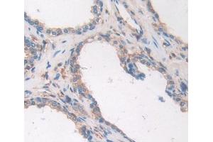 Used in DAB staining on fromalin fixed paraffin- embedded prostate gland tissue (ALOX12B anticorps  (AA 479-701))