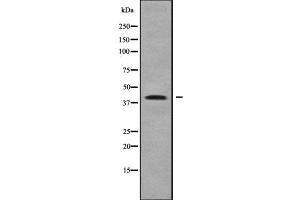 Western blot analysis of ZDHHC18 using LOVO whole cell lysates (ZDHHC18 anticorps  (N-Term))