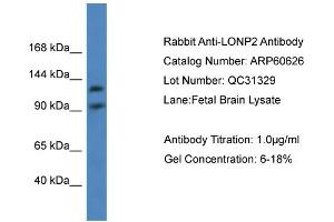 WB Suggested Anti-LONP2  Antibody Titration: 0.
