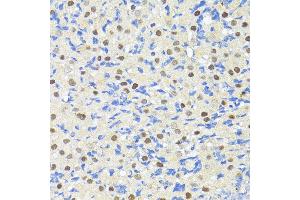 Immunohistochemistry of paraffin-embedded Rat ovary using TRIM27 antibody (ABIN7269922) at dilution of 1:100 (40x lens).