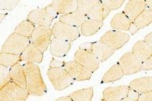 Immunohistochemistry analysis of paraffin-embedded mouse skeletal muscle using,DMPK (ABIN7073790) at dilution of 1: 2000