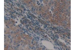 Detection of Hsp60 in Mouse Ovary Tissue using Polyclonal Antibody to Heat Shock Protein 60 (Hsp60)