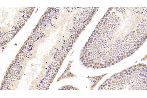 Detection of CTSD in Mouse Testis Tissue using Polyclonal Antibody to Cathepsin D (CTSD) (Cathepsin D anticorps  (AA 66-410))