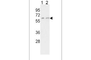 Western blot analysis of CYP7A1 Antibody (C-term) (ABIN392530 and ABIN2842085) in K562(lane 1), HepG2(lane 2) cell line lysates (35 μg/lane). (CYP7A1 anticorps  (C-Term))