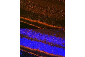 Immunofluorescence analysis of mouse eye using CRALBP Rabbit mAb (ABIN7269934) at dilution of 1:100 (40x lens).