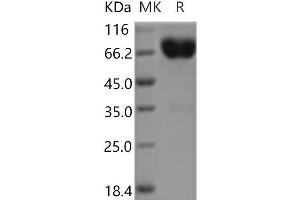 Western Blotting (WB) image for Interleukin 10 Receptor, beta (IL10RB) protein (Fc Tag) (ABIN7196363)