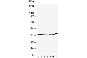 Western blot testing of Caspase-6 antibody  and Lane 1:  rat liver;  2: rat kidney;  3: rat testis;  4: NRK;  5: mouse liver;  6: mouse kidney;  7: mouse testis tissue lysate (Caspase 6 anticorps  (AA 7-27))