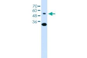 Western blot analysis of Jurkat cell lysate with SLC2A5 polyclonal antibody . (SLC2A5 anticorps  (AA 300-349))