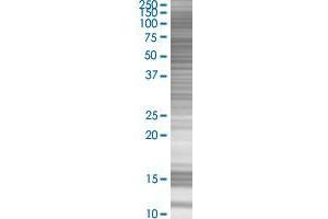 C21orf66 transfected lysate.