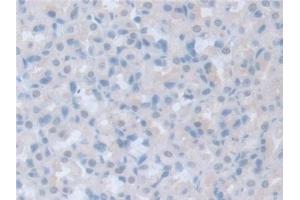 Detection of ITSN1 in Rat Stomach Tissue using Polyclonal Antibody to Intersectin 1 (ITSN1)