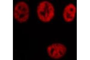 ABIN6274338 staining Hela cells by IF/ICC.