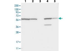 Western blot analysis of Lane 1: RT-4, Lane 2: U-251 MG, Lane 3: Human Plasma, Lane 4: Liver, Lane 5: Tonsil with ZNF354C polyclonal antibody  at 1:250-1:500 dilution. (ZNF354C anticorps)