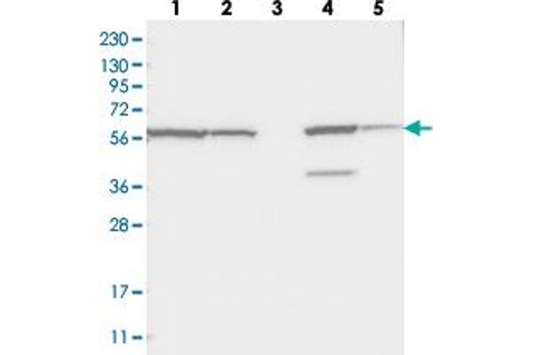 ZNF354C anticorps