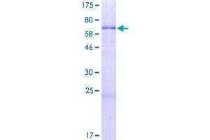 Image no. 1 for Potassium Channel Tetramerisation Domain Containing 7 (KCTD7) (AA 1-289) protein (GST tag) (ABIN1308508)