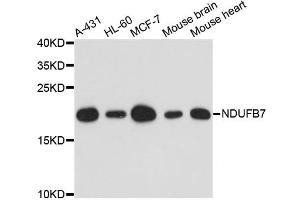 Western blot analysis of extracts of various cell lines, using NDUFB7 antibody. (NDUFB7 anticorps)